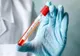 Bilanț coronavirus: Doar 9.148 de infectări și peste 200 de decese în ultimele 24 de ore