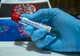 Bilanț coronavirus: 17.158 de infectări și 423 de decese în ultimele 24 de ore
